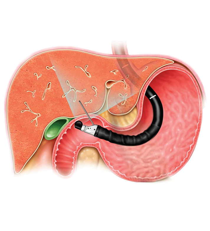 Dr. Shankar Bhanushali, best doctor for Endoscopic Ultrasound in Ulwe, Navi Mumbai, offers unparalleled expertise for optimal gastrointestinal health.