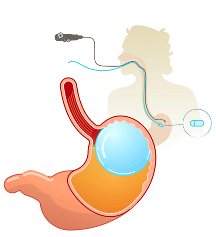 Dr. Shankar Bhanushali offers unparalleled gastrointestinal care & superior treatment in Ulwe, Navi Mumbai, the trusted & the best Enteroscopy doctor in Ulwe, Navi Mumbai.